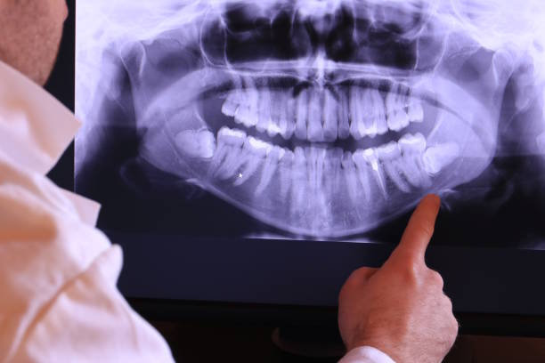 Best Urgent Tooth Repair  in Cross Roads, TX